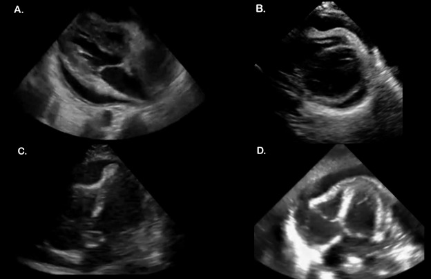 Can AI Reduce Operator Dependency in Portable Medical Imaging?